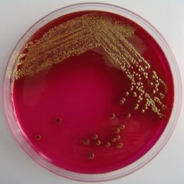 STUDIU Corpul unui om imprastie 37 de milioane de bacterii pe ora